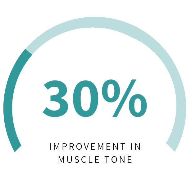 Graphic Showing A 30% Improvement In Muscle Tone With Emface Treatment At Optimum Human In Albuquerque, Nm.