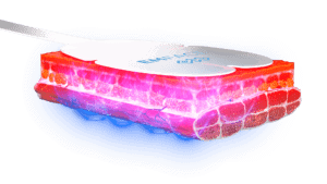 Emface Skin